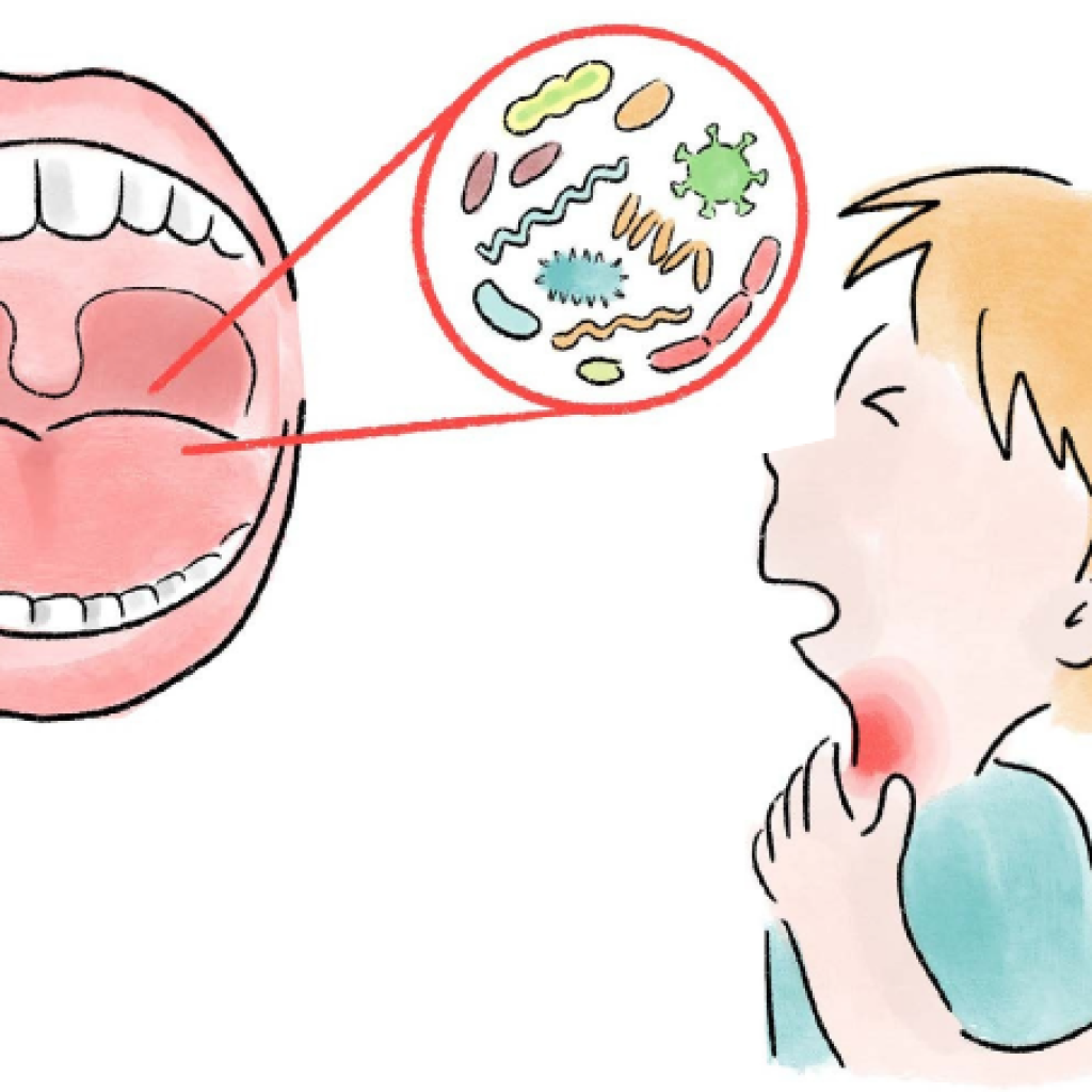 Strep A: What is it and what to look out for as a parent